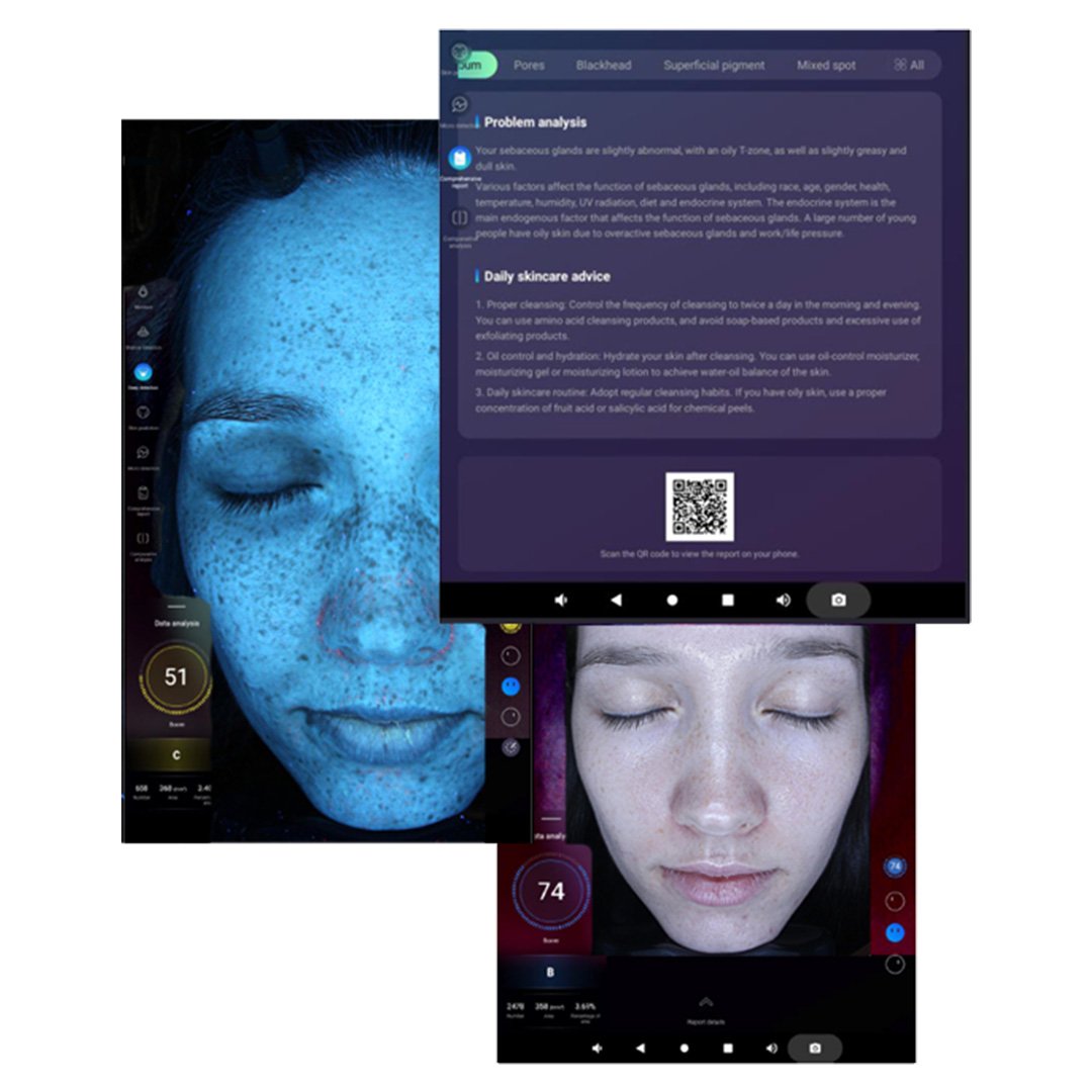 Pure Tone Derma Vu Photographic Skin Analysis Machine - Image 4